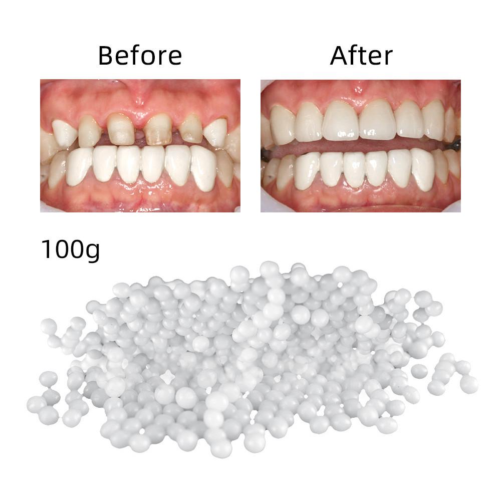 Temporary Tooth Repair Kit Thermal Molding Teeth Repair Replacement Fitting Beads Denture Repair