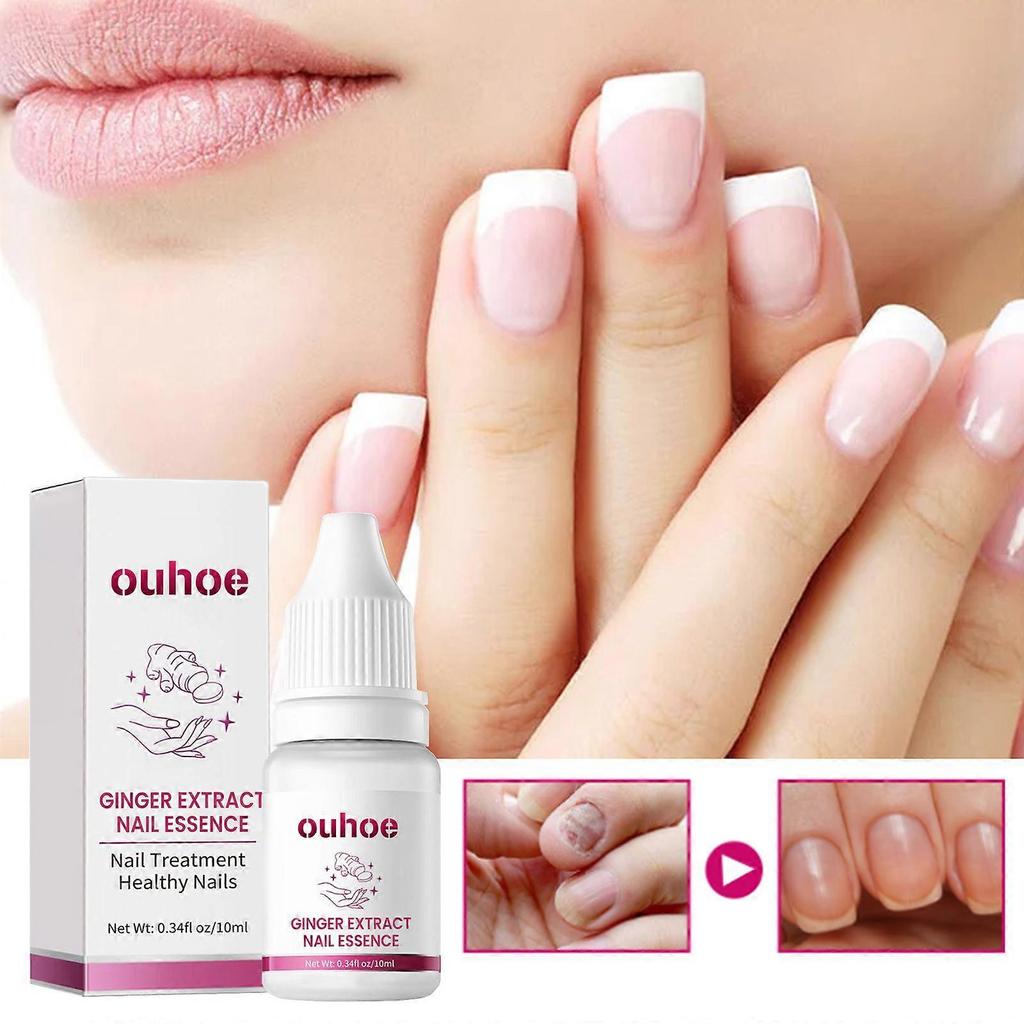 1-5x OUHOE Ingwer Nagelpflege Essenz, Graue Nägel Feuchtigkeitspflege Peeling Schönheitsnagel Essenz