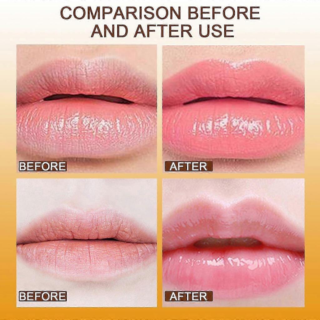 Hydrating Lip Balm with Beeswax & Shea Butter  Anti-Cracking, Reduces Lip Lines, Overnight Lip Mask, Non-Greasy, 20ml