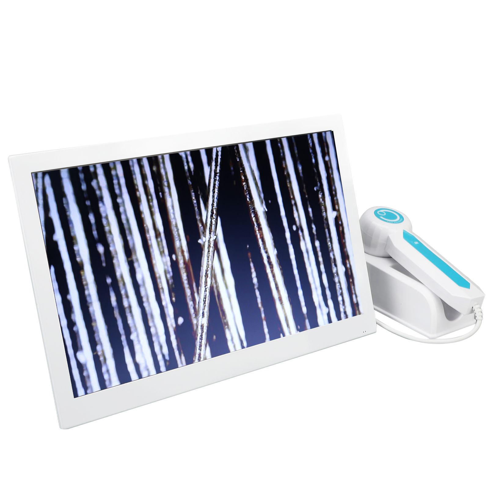 

Диагностика кожи Анализатор волос 14 дюймов Цифровой пульт дистанционного управления Машина для обнаружения фолликулов кожи головы US Plug