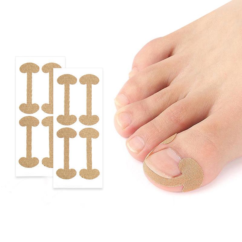 Ingrown Toenail Correction Strips Lasting Adhesion Waterproof Nail Correction Stickers Elasticity Toe Care Pedicure Tools