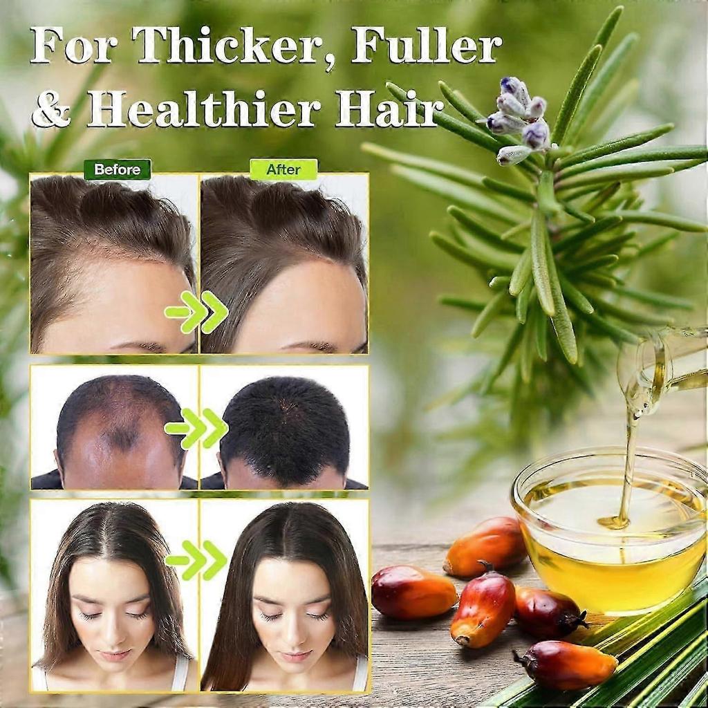 Hair Growth Oil with Batana Oil and Rosemary Oil, Batana Oil with Rosemary, Nourishes Scalp, Repairs Split Ends, Stimulates Hair Growth