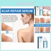 Jaysuing Scar Gel For Effective Scar Reduction And Smoothing Skin Appearance 30g Premium Quality Formula