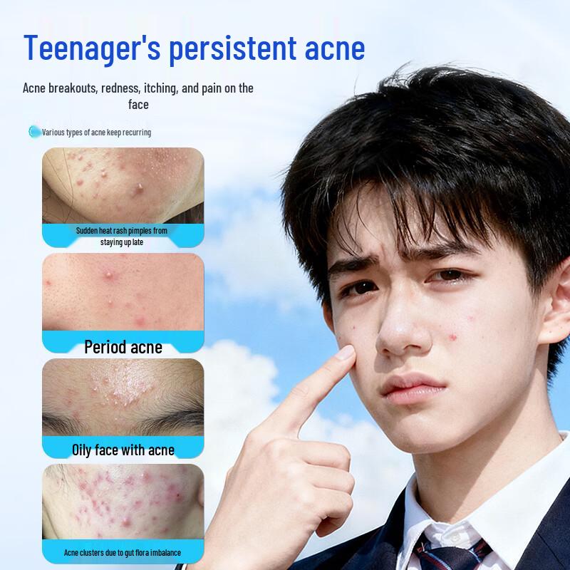 Shuangfeiren Youth Acne Cream