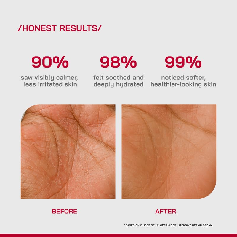 PHD 1% Ceramides Intensive Repair Cream 30ml X Pack of 2 for Dry, Sensitive & Eczema-Prone Skin