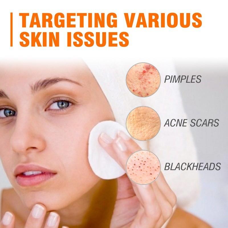 West Month Salicylic Acid Facial Mask Gentle Cleansing Reduces Acne Scars Pore Tightening