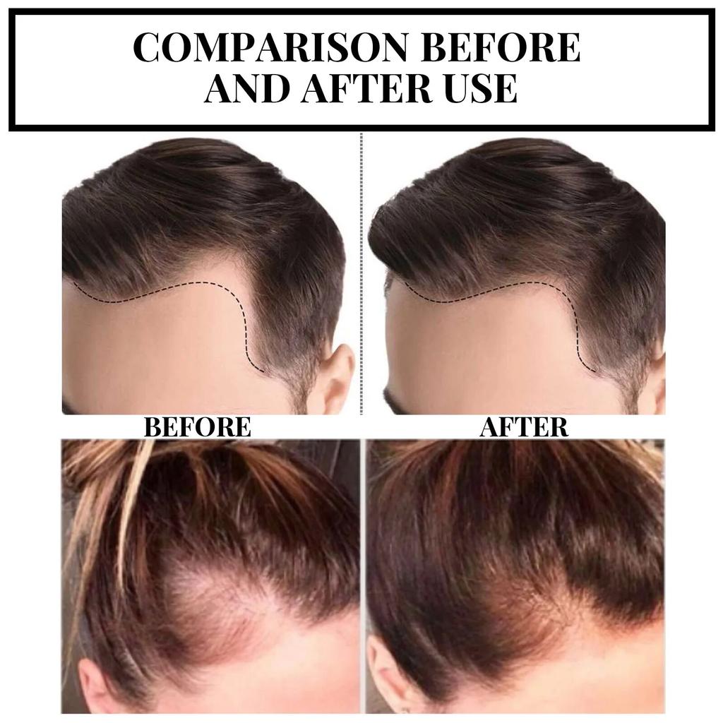 EELHOE Hair Growth Ginger Essential Treatment Scalp Dry Frizz Damaged Hair Anti Hair Loss Hair Care Serum Fas