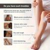 Whitening Cream for Dark Skin Armpit Lightening Intimate Areas Underarm Body Skin Care Private Parts Whiten Cream Beauty Health