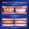 Baking Soda Probiotic Whitening Toothpaste To Remove Yellow Teeth Stains and White Teeth Removal Clean Teeth Fresh Mouth 300g