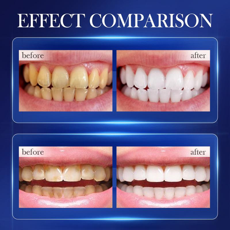 Baking Soda Probiotic Whitening Toothpaste To Remove Yellow Teeth Stains and White Teeth Removal Clean Teeth Fresh Mouth 300g