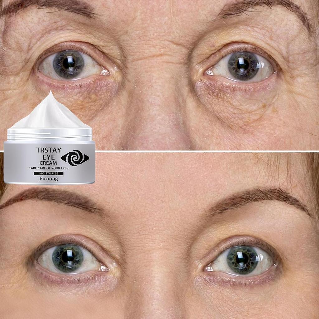 Oční krém redukuje výskyt vrásek kolem očí, vyplňuje a vyhlazuje oční okolí, účinně rozjasňuje a zpevňuje