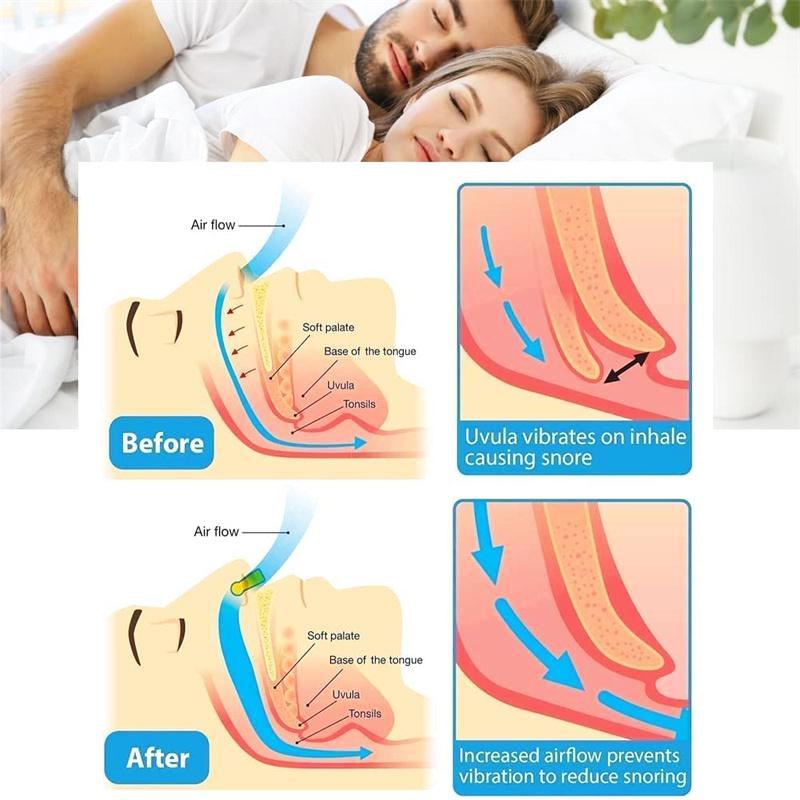 2 Pieces Women Men Anti-snoring Device Comfortable Anti Snoring Nose Clips Anti Snoring Corrector