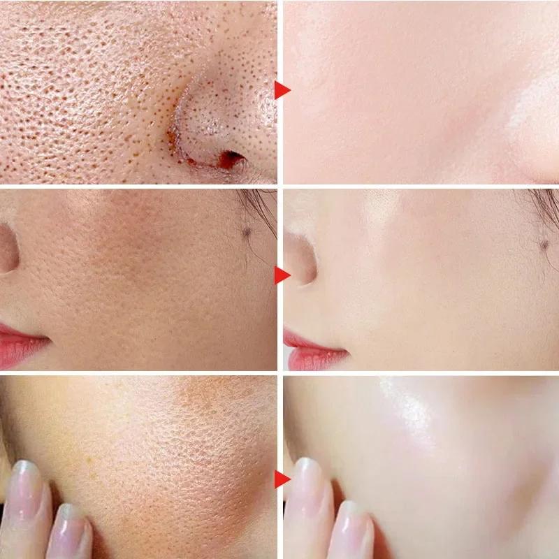 Crema restringente i pori all'acido salicilico Eliminazione rapida Pori dilatati Rimuovi i punti neri Stringi il prodotto per la cura della pelle liscia del viso