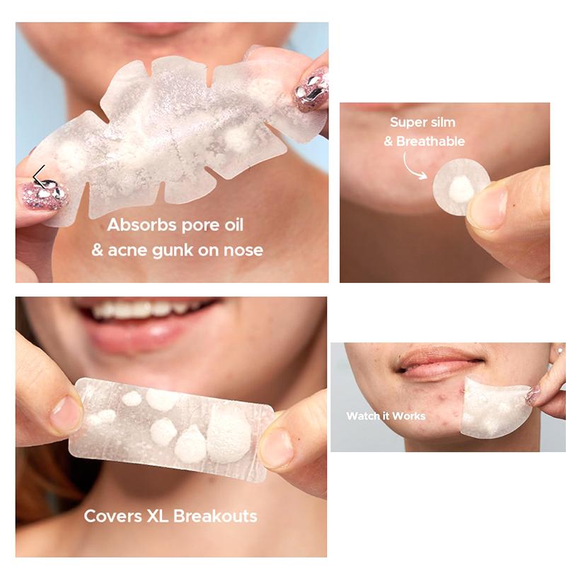 364Pcs Invisible Pimple Removal Anti-Acne Patches Spots Marks Concealer Beauty Makeup Tool Repair Sticker