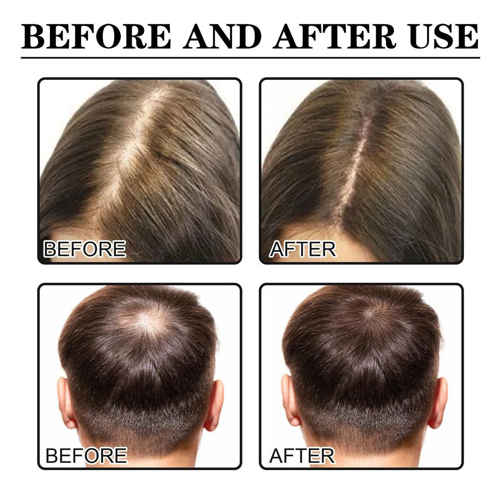 Jaysuing Dense Hair Essence Strong and Strong Repararea părului Rădăcina părului Gros Hairline Essence hidratează părul