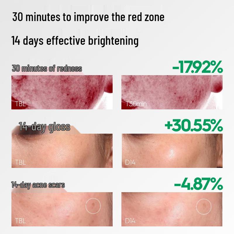 Revitalizing 5% Tranexamic Acid Brightening Repair Serum