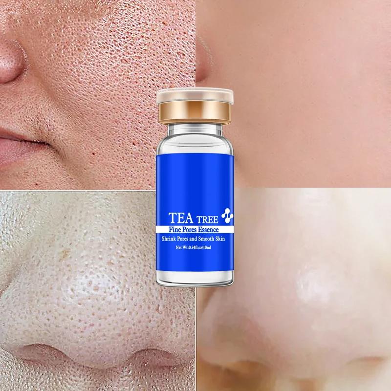 Tea Tree Liquid Whitening Spot Essence Shrink Pores Ampoule Anti-acne Regenerative Essence