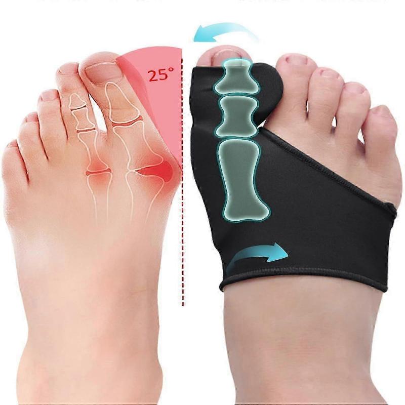 2 Pcs Bunion Corrector for Women Men Bunion Pain Relief, Big Toe Straighteners