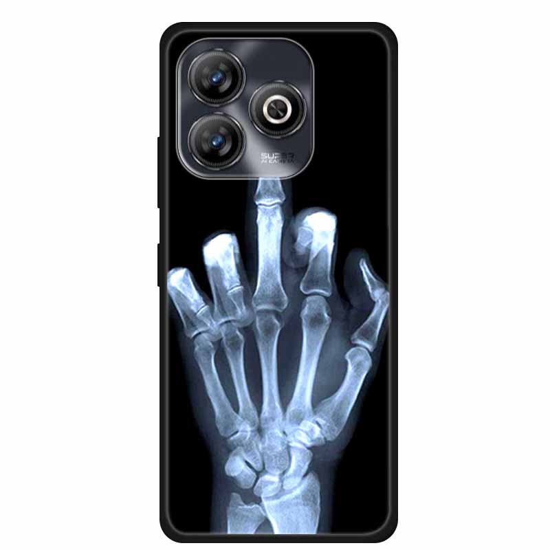 Pro ZTE BLADE A75 4G Pouzdro Zvířata Měkký Silikon TPU Pouzdra na Telefon Zadní Kryt Pro ZTE BLADEA75 Nárazuvzdorný Vlk Ochranný Cool Coque