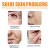 Treatment of Puffy Eyes and Dark Circles Improve Wrinkles and Fine Lines Moisturizing Firming and Lifting Eye Patch Can Make Your Skin Look New