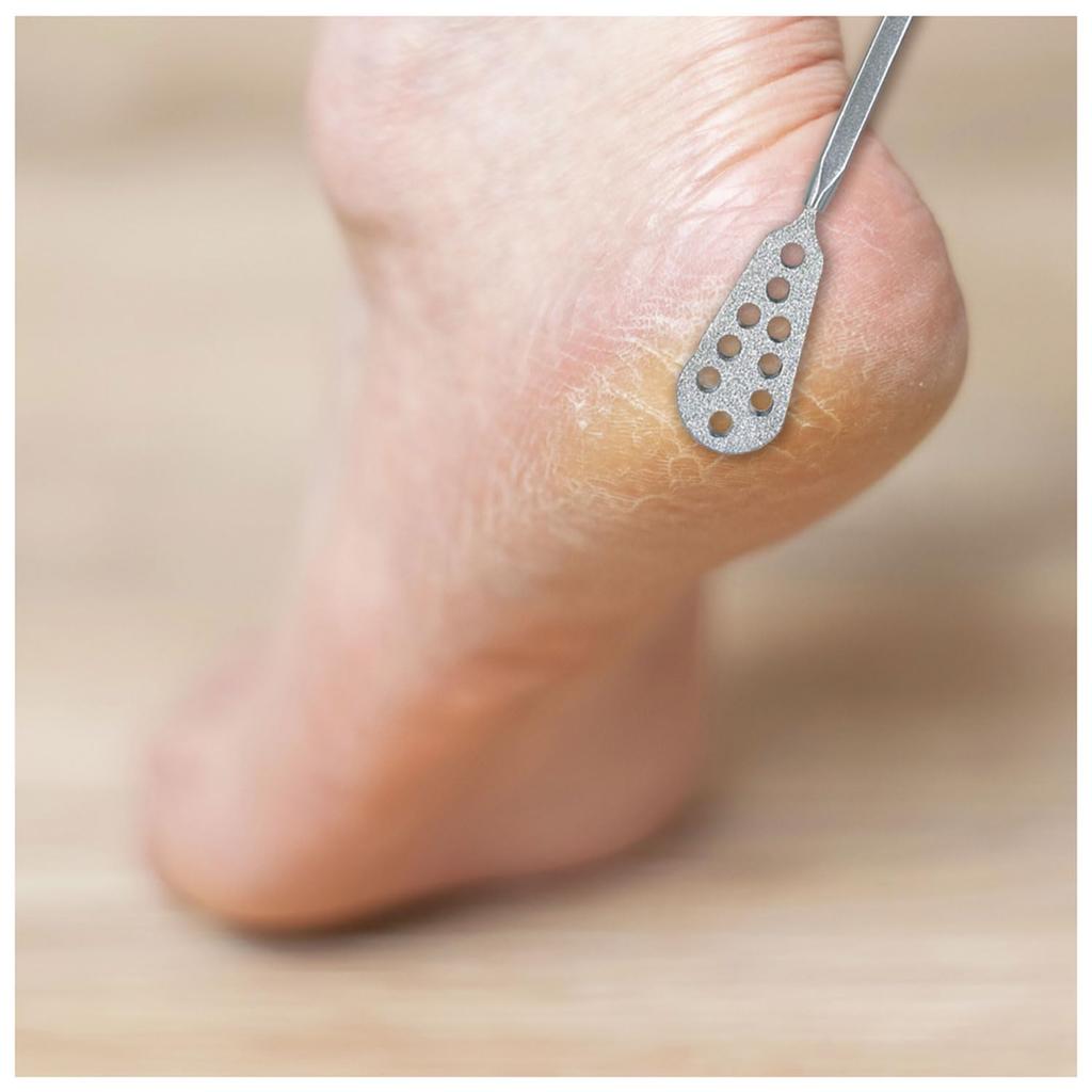 Rooro Pinpoint Callus File RO-PY