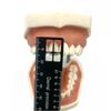 1Pc Dental Lab Multifunction Ruler for Aesthetic Crown Bridge Design Prosthodontic Measurement Multi-Window Scale Instrument