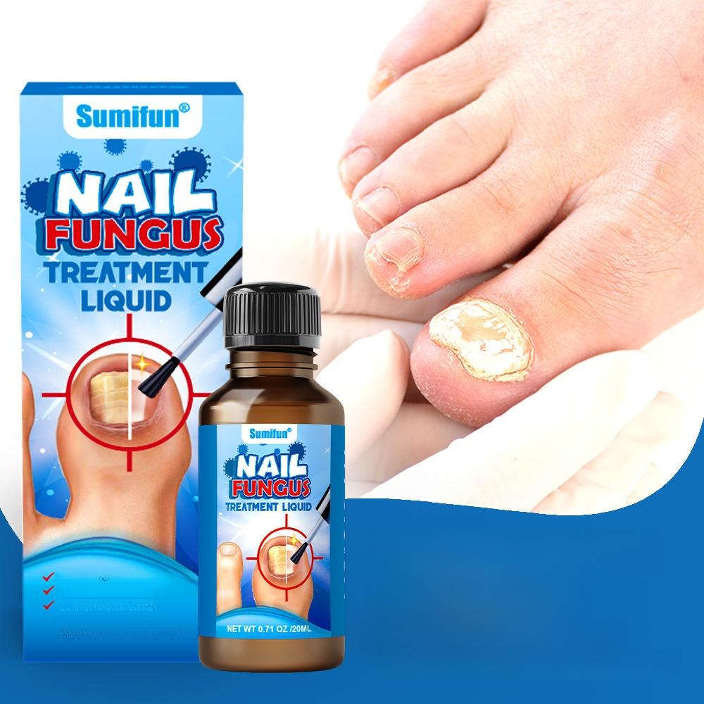 

Средство для восстановления ногтей Sumifun от онихомикоза и грибка ногтей 20ml