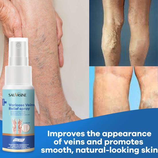 

30 мл Многофункциональный компактный спрей для лечения варикозного расширения вен на ногах Vintage Leg Swelling Care