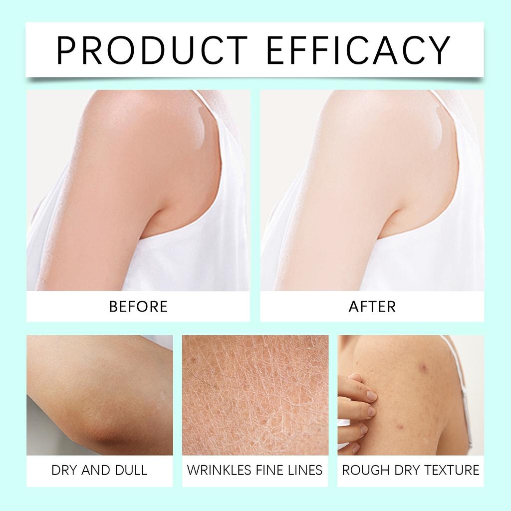 Thyme Balm Soothing And Nourishing Balm Discomfort Relief Aromatherapy Body Balm To Promote Blood Circulation Gentle Nourishing Body Cream
