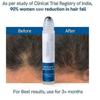 3X Be Bodywise Hair Growth Serum Roll On - 3% Rosemary, 3% Redensyl & 2%
