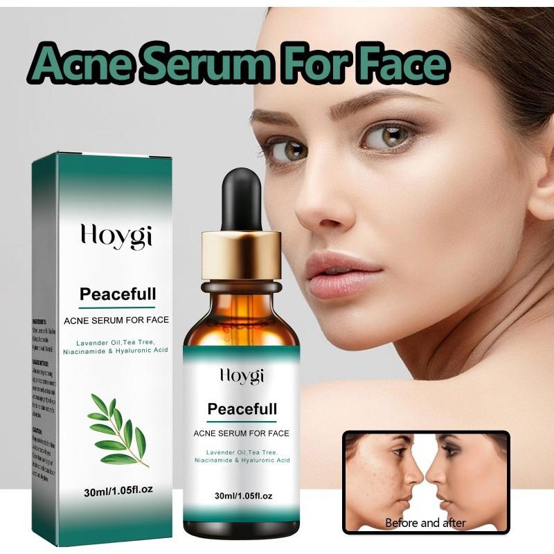 Hoygi Acne Essence With Hydrating Properties For Reducing Blemishes And Pore Refinement