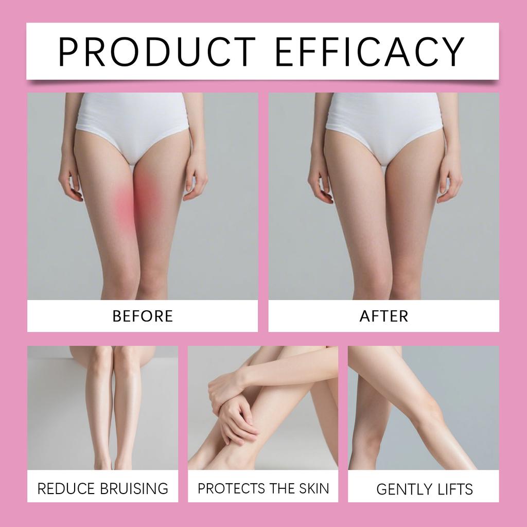 Leg Anti-abrasion Patches Prevent Thigh Friction, Reduce Scratches, Lift And Shape, And Apply Anti-abrasion Patches.