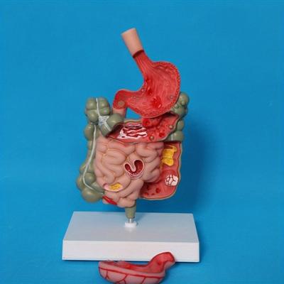 Human Digestive System Model Stomach Anatomy Large Intestine Cecum Rectum Duodenum Human Internal Organs Structure Model