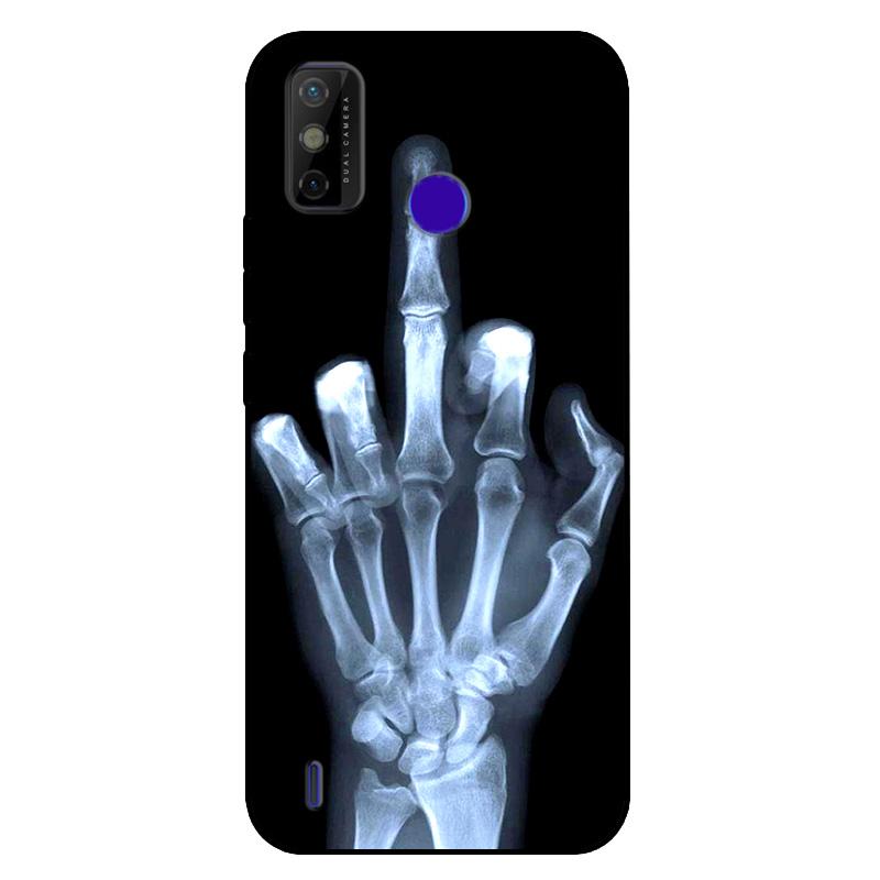 For Tecno Spark 6 GO Case Shockproof Soft Silicone TPU Back Cover For Tecno Spark 6 Go Phone Cases Spark6 GO Case Cute Cartoon