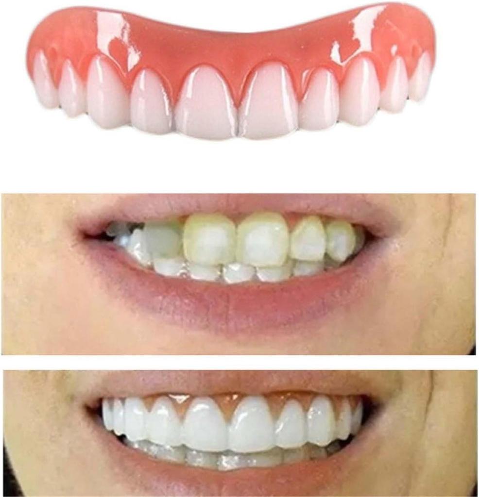 Silicone False Temporary Chipped Emergency Natural and Comfortable Cover Imperfect Instantly Smile with Confidence Dentures, Teeth, Teeth, Teeth, Fix,