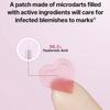NEEDLY Patch for Blemishes Colorful (12 Patches)