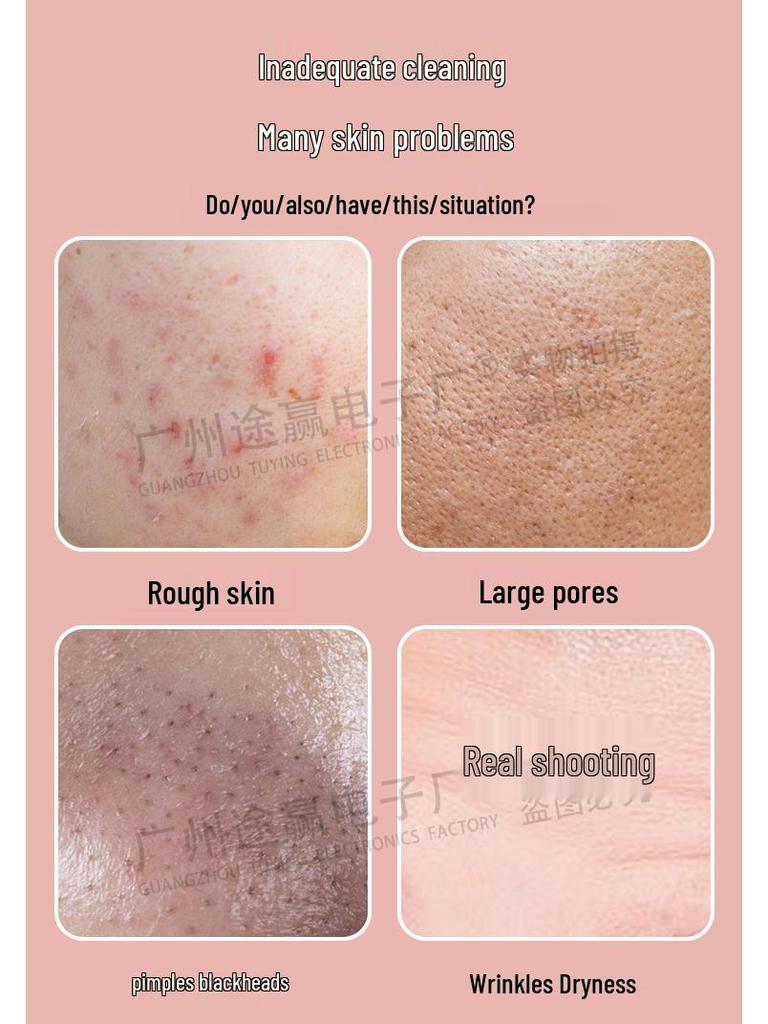 EMS Microcurrent LED Rejuvenation Device: Needle-Free Electroporation & RF Beauty Tool