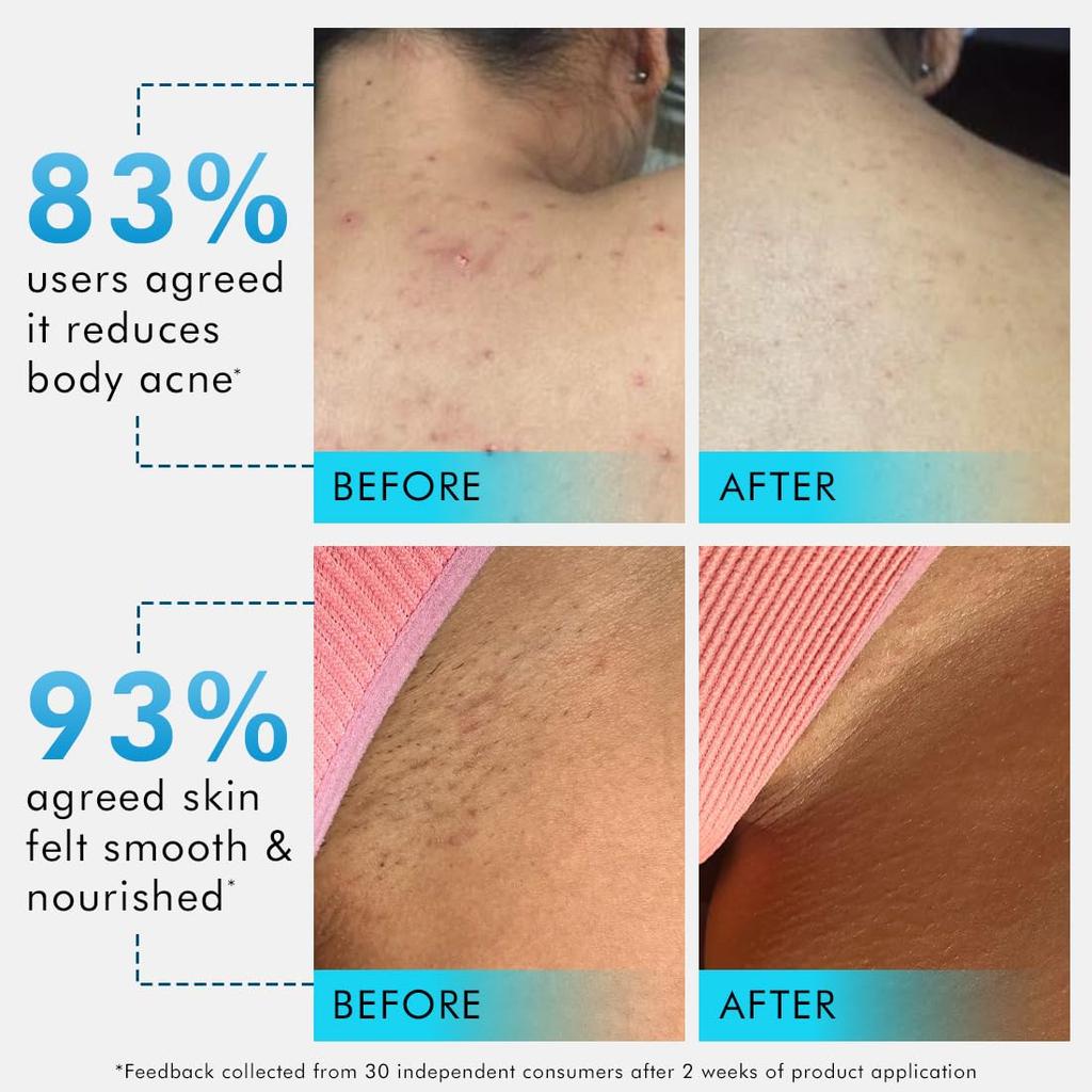 mCaffeine 3-in-1 Parfüm Körperwäsche mit 2% Salicylsäure für Männer & Frauen, 250 ml, Geruchskontrolle & Glatte Haut