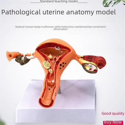 Large Female Reproductive Anatomy Model for Teaching and Family Planning