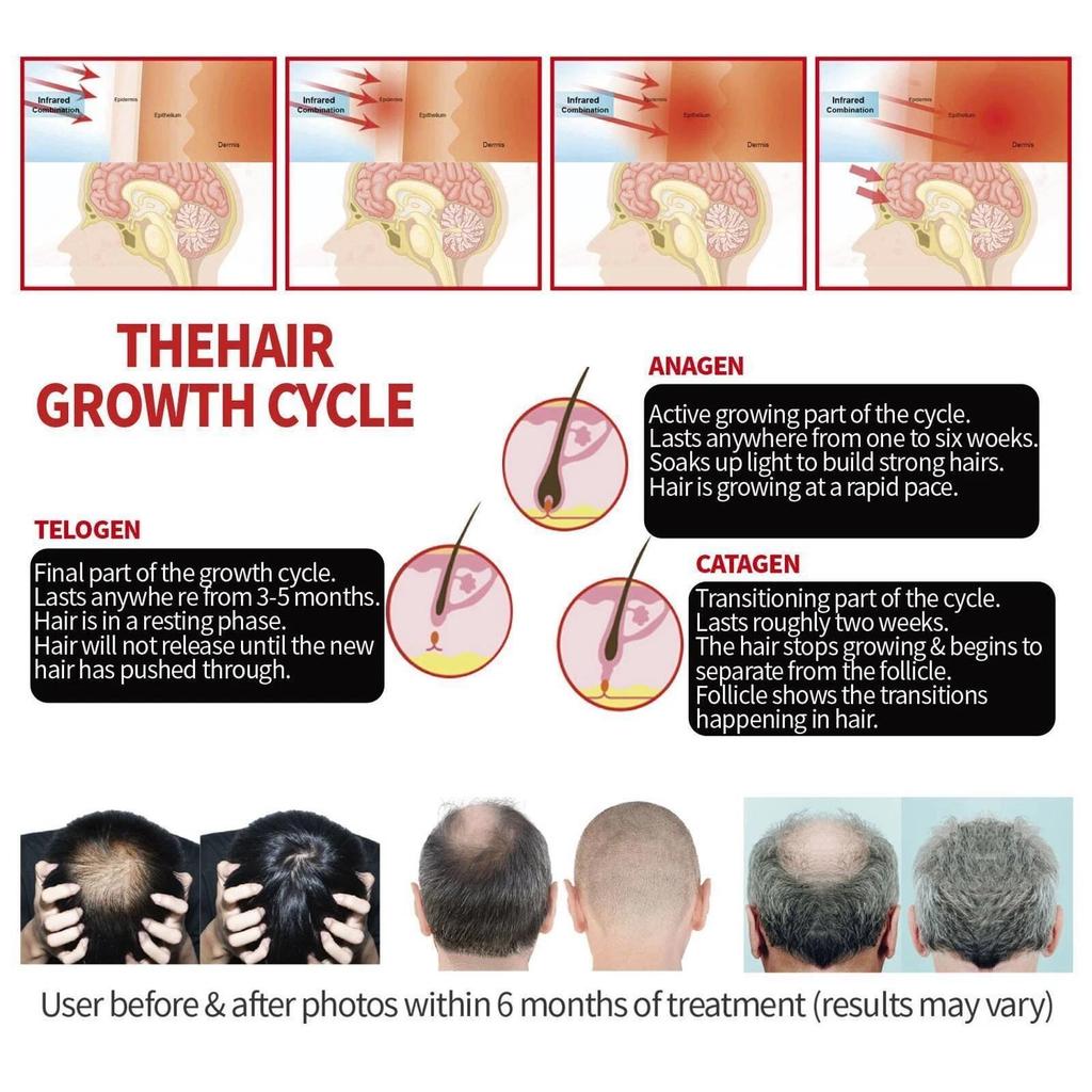 Hair Beauty Product Recharge Regrowth Hair LED Hair Cap Helmet Treating Hair Loss Reduce Hair Loss Hair Growth Scalp Healthy Equipment
