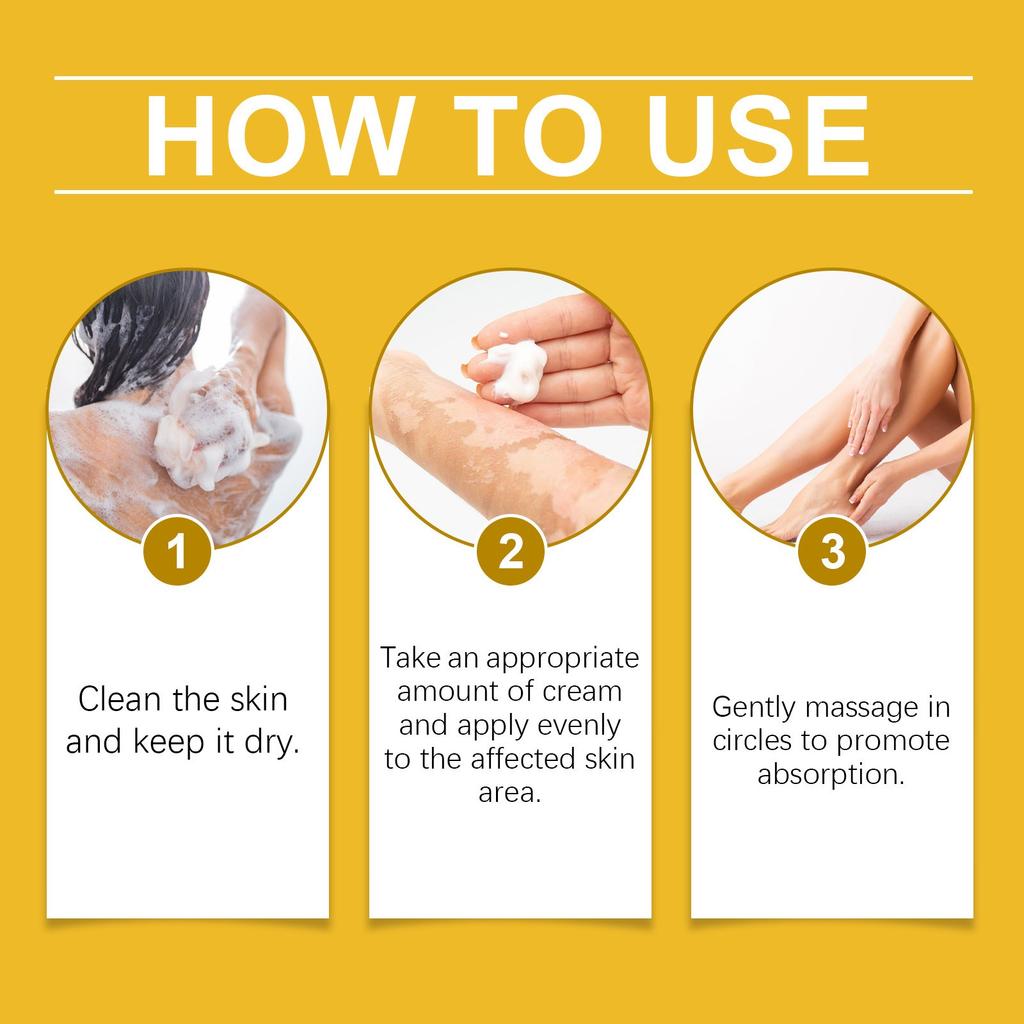 Vitiligo Relief Cream, Skin Care Cream, Vitiligo Cream, Improves Dryness, Suitable For All Skin Types