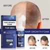 3pcs Regaine For Men Hair Loss Regrowth Scalp Foam - Extra Strength-yvan
