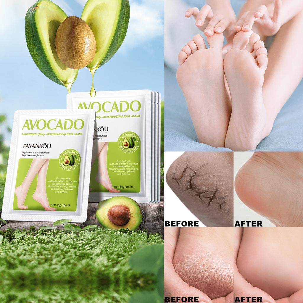 1/3/5/10Pairs Avocado Moisturizing Foot Mask,Exfoliate To Minimize Foot Lines,Get Rid Of Dead Skin A