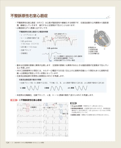 160 ECG Questions & Thorough Explanations To Pass Level 2 & 3 Exams - Get Stronger for the Actual Exam with Randomly Selected Practice Questions and P