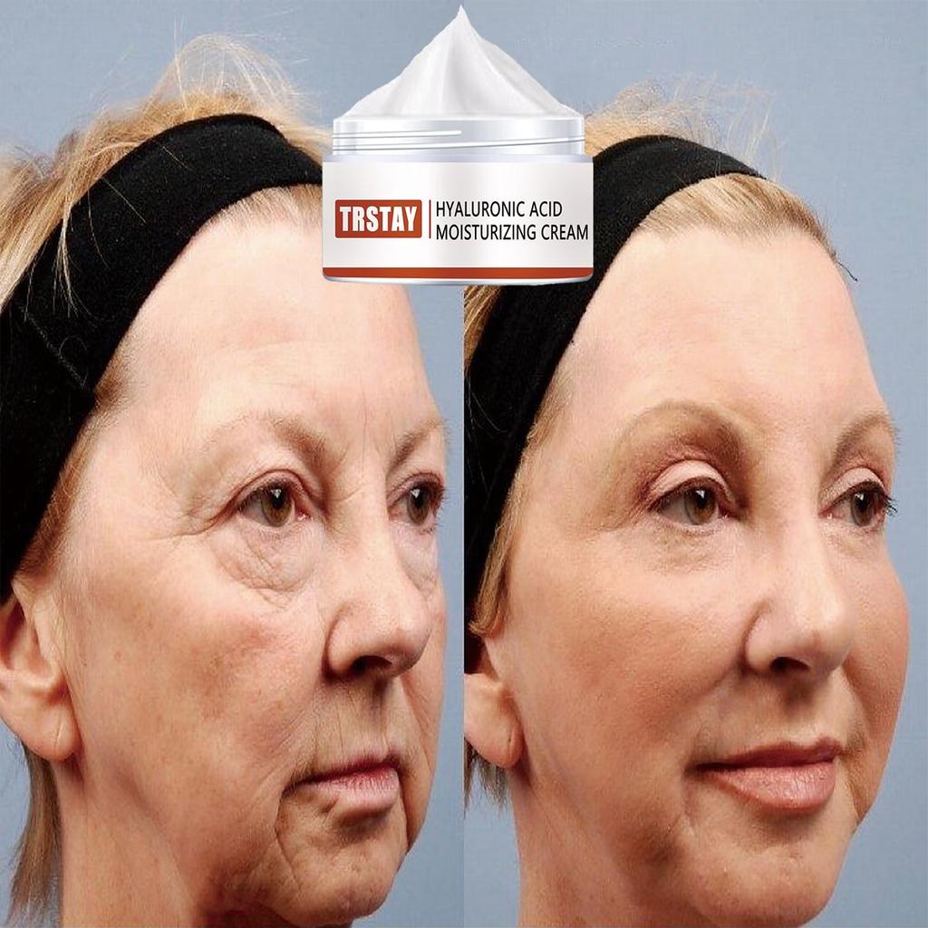 Wrinkle Reduction Brightening Facial Lifting Moisturizer is gentle and non-irritating, firming the skin, brightening the complexion