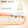 OEDO Nail Repair Treatment Ginseng Nail Essential Oil Nail Art & Tools Healthy Nail Treatment Foot Care