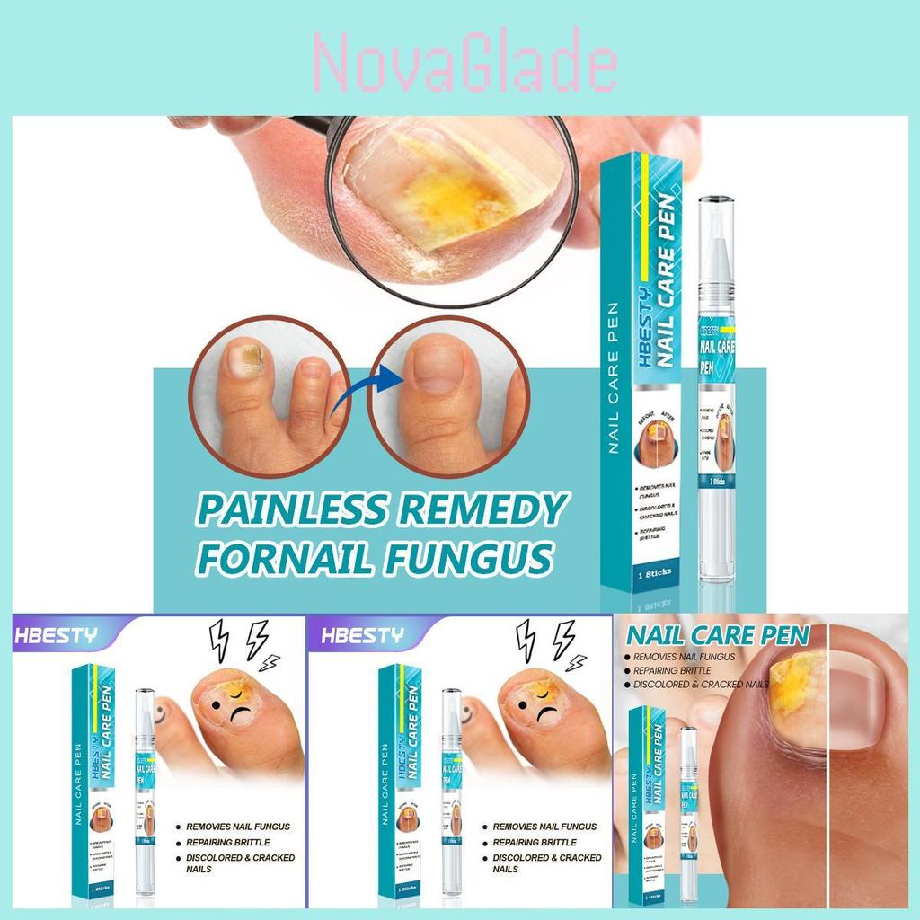 Hbesty Nagelpflege Stift Kräuterduftende Fußbehandlung für gesunde Nägel und Haut