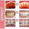 2025 Sp 10 Toothpaste, Sp-10 Toothpaste, Ultra Whitening Toothpaste Sp-10, Sp-10 Probiotic Brightening Whitening Toothpaste, Fresh Breath