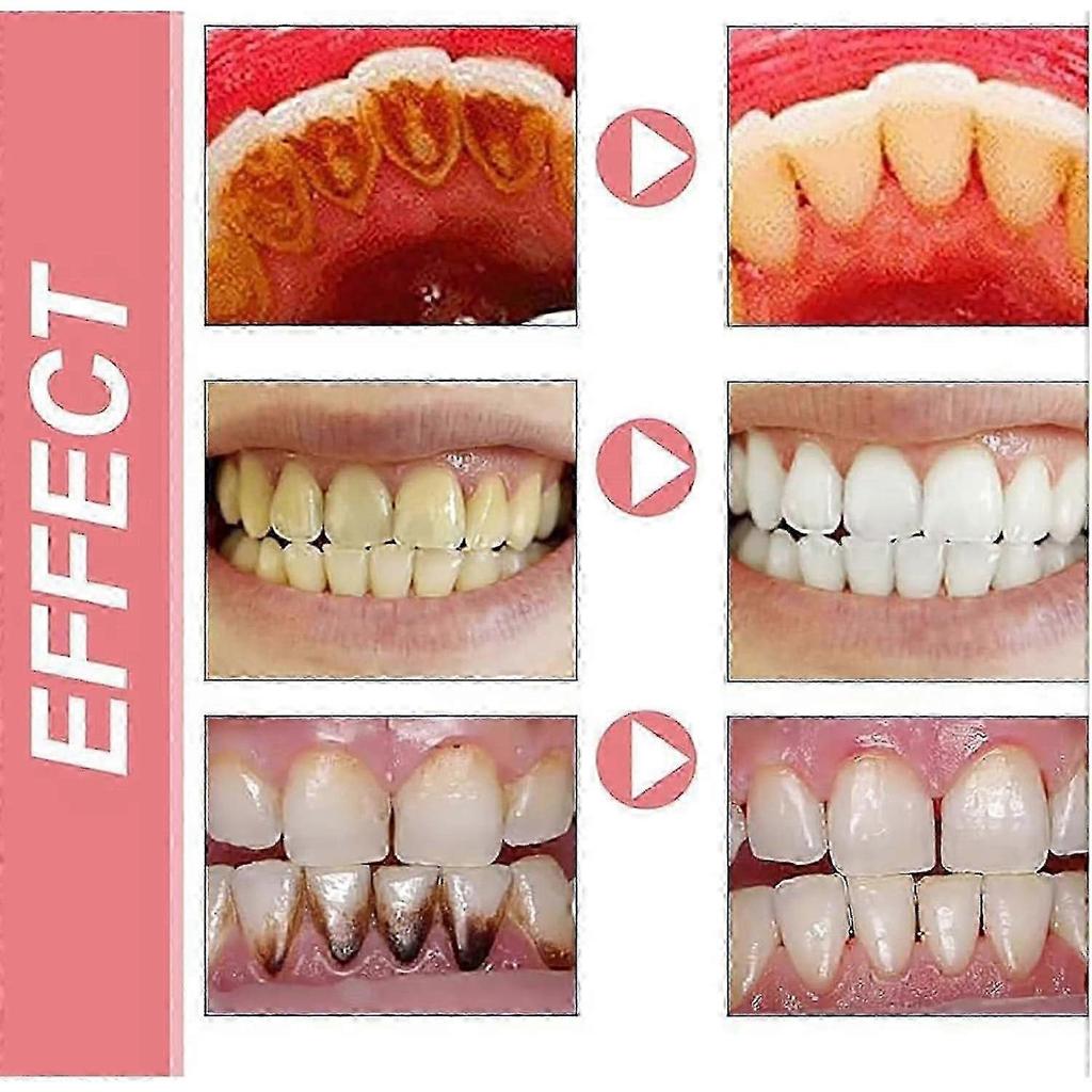 2025 Sp 10 Toothpaste, Sp-10 Toothpaste, Ultra Whitening Toothpaste Sp-10, Sp-10 Probiotic Brightening Whitening Toothpaste, Fresh Breath