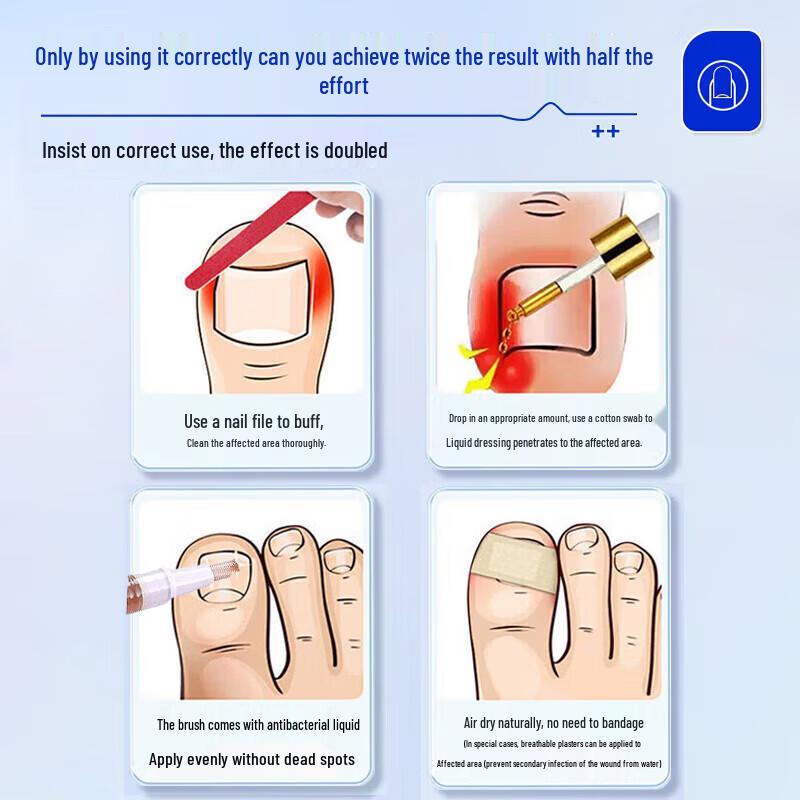 Tong Ren Tang Fungal Nail Repair Solution